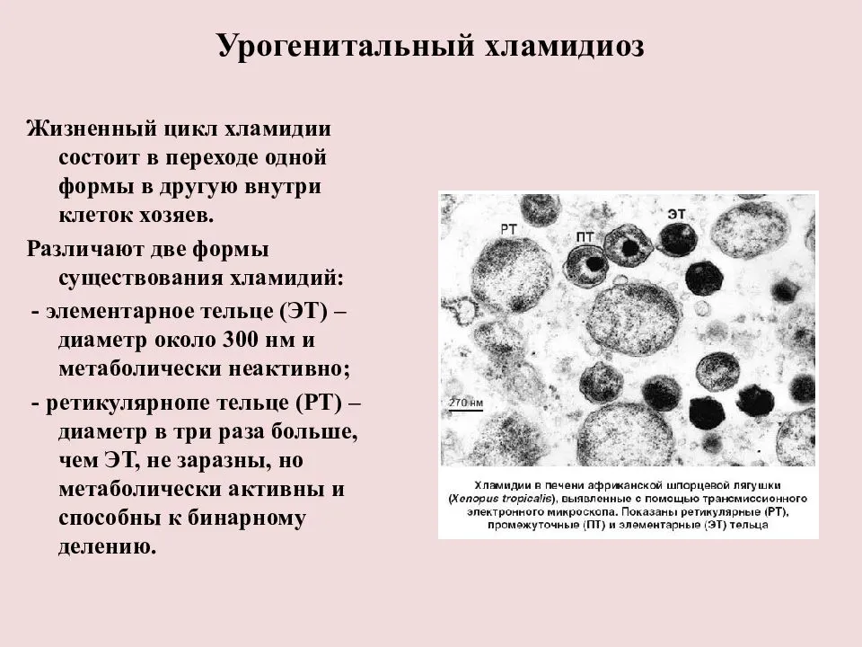 Болезнь хламидиоз презентация