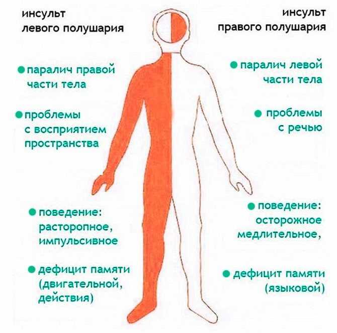 Абсцедирующая пневмония: причины, симптомы и лечение | медицинский центр «президент-мед»