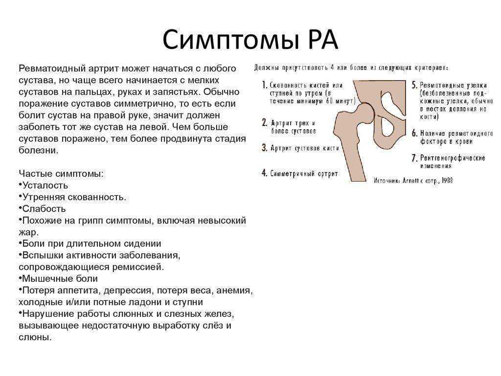 Подагра: симптомы и методы лечения. диета и препараты при подагре.