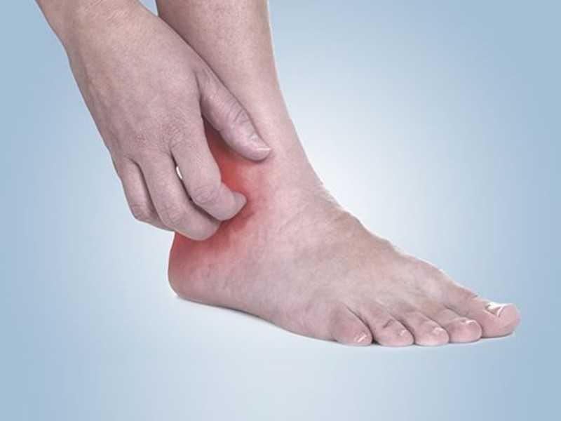 Боль в ногах (лодыжках, ступнях, пальцах ног). что делать при боли в ногах, причины боли в ногах.